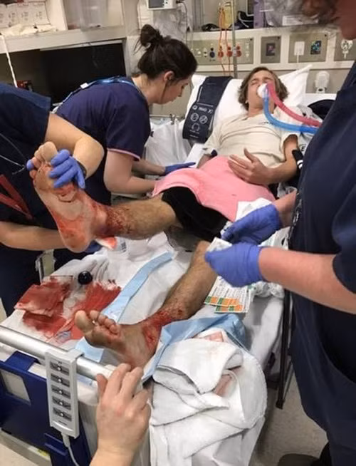 Cha của Sam, ông Jarrod Kanizay cho biết, trước khi đến bệnh viện, gia đình đã lau được cả một vũng máu chảy ra từ những vết thương trên chân của Sam. Đáng nói, sau khi lau đi nhưng vệt máu, trên chân của cậu thiếu niên đáng thương có hàng trăm vết thương hở. Sam ngay lập tức được đưa tới bệnh viện. (Nguồn Sina)