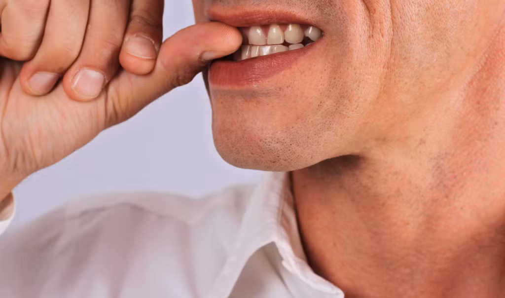 Việc cắn móng tay còn tạo điều kiện cho vi trùng, vi khuẩn dễ dàng xâm nhập vào cơ thể. Ảnh: hellobacsi