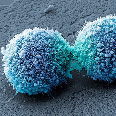 Ung thư da. Ánh sáng mặt trời có tác dụng sát khuẩn, đó là do tia tử ngoại có thể phá hủy các vi khuẩn phá hoại tế bào. Tuy nhiên, tia tử ngoại cũng khiến cho các loại khuẩn có tác dụng bảo vệ trên bề mặt da của chúng ta bị tiêu diệt theo. Chính điều đó sẽ dẫn đến hệ thống miễn dịch giảm, mắc các loại bệnh về da, thậm chí ung thư da.