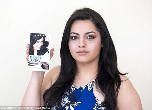 Cô Dinya Rasool ở Cargiff, Anh đã thề không bao giờ nhuộm tóc nữa vì bị dị ứng thuốc nhuộm đến nỗi khuôn mặt sưng vù, da đầu liên tục chảy mủ và bong tróc thành từng mảng.