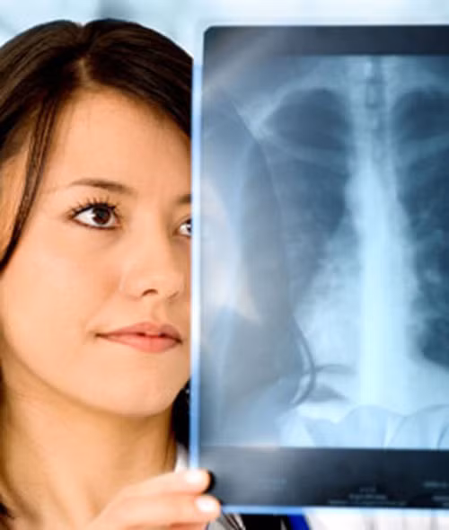 1 tháng sau. Lúc này phổi sẽ sửa chữa hết những hư hỏng do thuốc lá tàn phá. Các lông mao và bào quan tóc nhỏ xíu tiếp tục công việc của nó một cách năng suất là đẩy chất nhầy ra ngoài làm cho bạn dễ thở hơn.