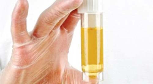 Triệu chứng là bạn sẽ có cảm giác rát khi tiểu tiện và tăng số lần đi tiểu. Một số loại thuốc còn làm cho nước tiểu ngả màu đỏ hoặc cam.