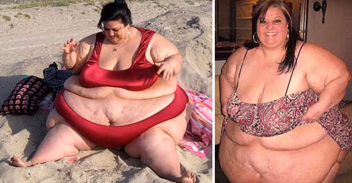 Quyết định giảm cân đã ảnh hưởng đến hạnh phúc gia đình, cô phải chia tay với người chồng, người luôn phục vụ cô hàng ngày, nấu cho cô ăn, chăm sóc cho cô. Patty đau khổ và buồn bã nhưng cũng nghiệm ra một điều rằng, nếu tiếp tục tình trạng béo phì cô sẽ chết sớm.