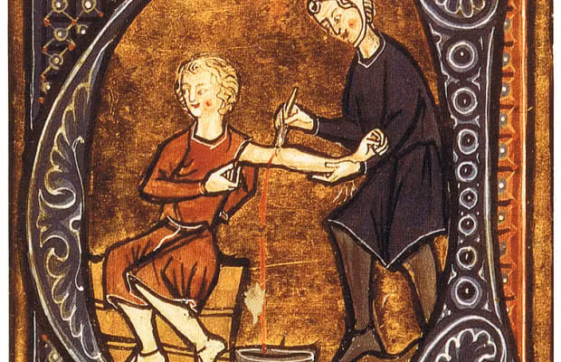 Họ làm như vậy vì cho rằng, "máu xấu" được loại bỏ khỏi cơ thể bệnh nhân sẽ khiến "ma quỷ" trú ngụ bên trong bị loại trừ. Theo đó, người bệnh sẽ khỏe mạnh trở lại.