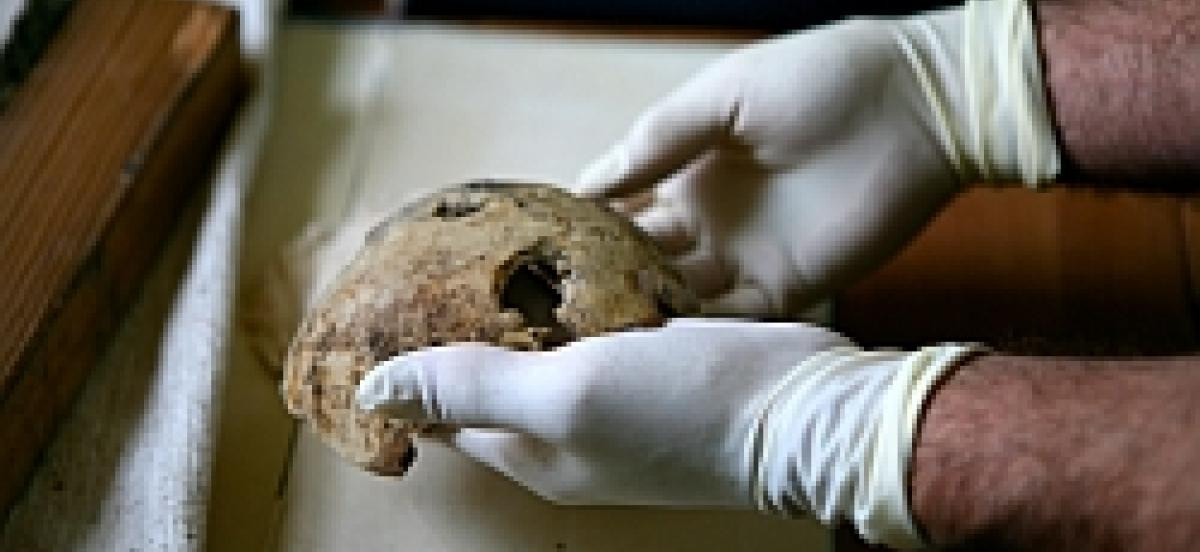 Theo một số nguồn tin, mảnh xương hàm và hộp sọ có một lỗ thủng do bị đạn bắn của Hitler được lưu giữ tại kho lưu trữ bí mật của Nga. Những phần thi thể này của Hitler lần đầu được trưng bày tại Moscow trong một cuộc triển lãm về Thế chiến 2 vào năm 2000. Mời quý độc giả xem video: Hitler còn sống sau Thế chiến 2 (nguồn: VTC14)