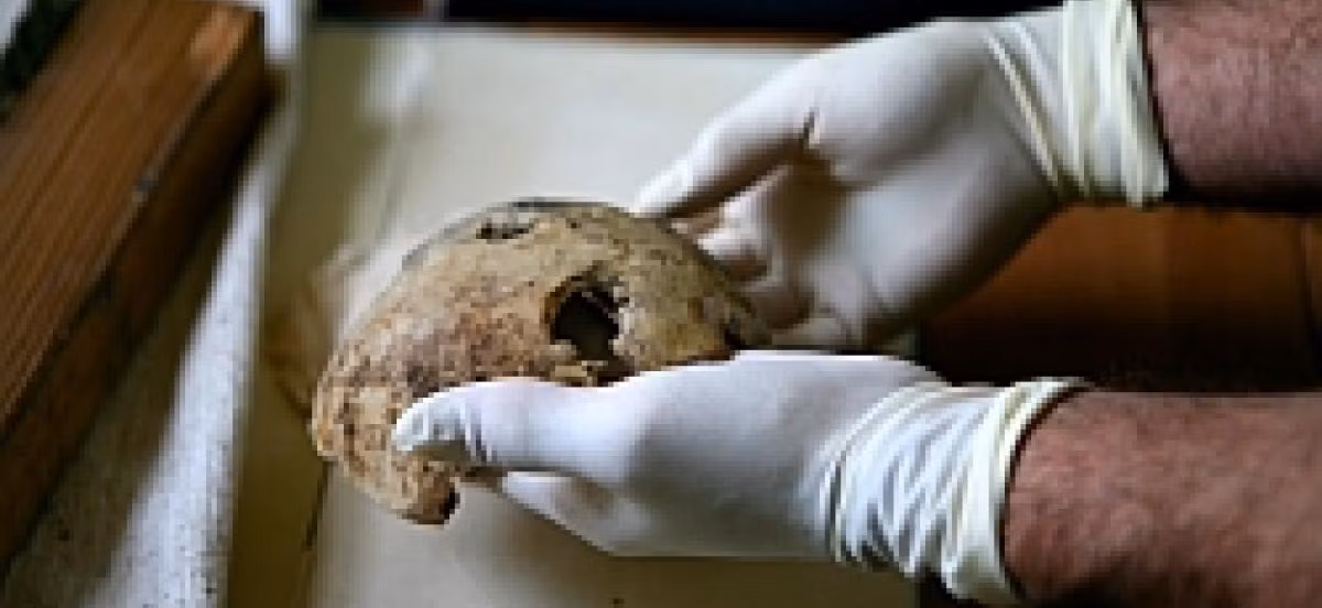 Theo một số nguồn tin, mảnh xương hàm và hộp sọ có một lỗ thủng do bị đạn bắn của Hitler được lưu giữ tại kho lưu trữ bí mật của Nga. Những phần thi thể này của Hitler lần đầu được trưng bày tại Moscow trong một cuộc triển lãm về Thế chiến 2 vào năm 2000. Mời quý độc giả xem video: Hitler còn sống sau Thế chiến 2 (nguồn: VTC14)