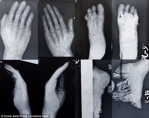 Cha mẹ của bé buộc phải là đôi chân đưa chúng đi khắp nơi, hoặc để chúng tự bò.