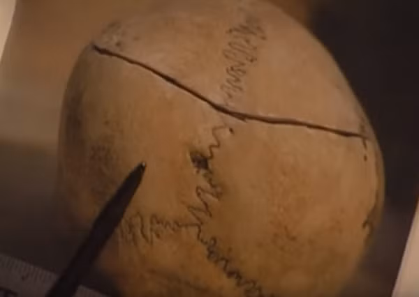 Nhưng khi xem ảnh hộp sọ Bun Chee, chuyên gia pháp y khẳng định hộp sọ nạn nhân nứt và lõm vì chịu lực tác động từ một vật cứng. Vết nứt trên hộp sọ cho thấy, Richard không chỉ làm ngạt Bun Chee, mà còn nện vật cứng vào đầu cô.