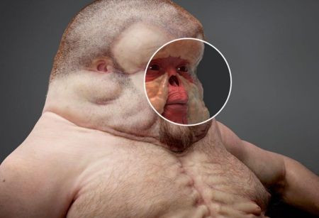 Ngoài ra, việc không có cổ sẽ giúp Graham không bị gãy xương cổ trong khi khuôn mặt phẳng và béo được thiết kế giúp bảo vệ mũi và tai.