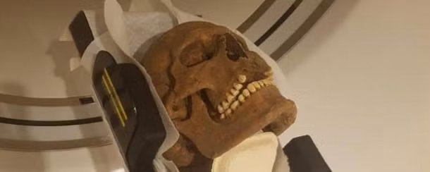 Thông tin này được đưa ra sau khi các chuyên gia tại Đại học Gothenburg thực hiện nghiên cứu 15 hộp sọ của người Viking được tìm thấy tại nhiều địa điểm ở châu Âu. Ảnh: Carolina Bertilsson.