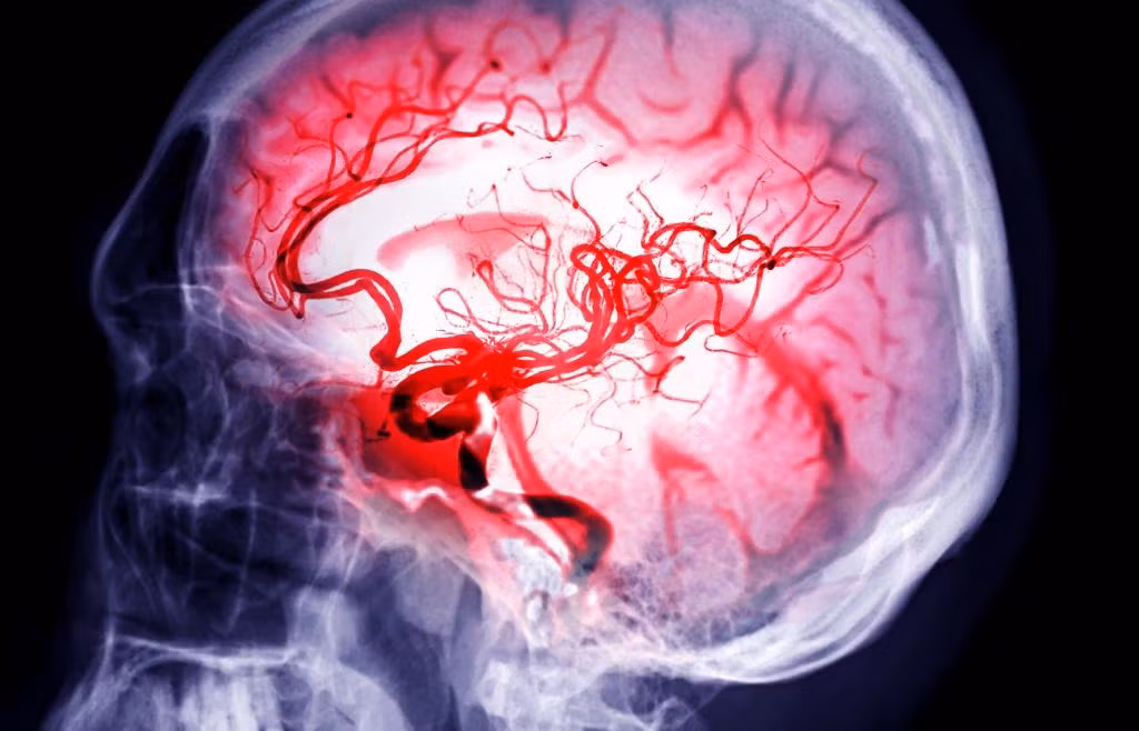 Các nhà nghiên cứu cho biết lời giải thích khả thi nhất là các xung điện được giải phóng khi não bị thiếu oxy. Ảnh: samunella – stock.adobe.com.