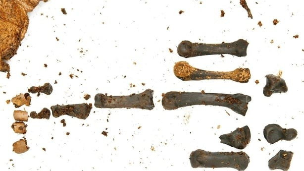 Nhóm nghiên cứu không tìm thấy phần đầu của người phụ nữ chết cách đây khoảng 2.000 năm nhưng các chuyên gia cho rằng những phân tích sâu hơn về phần còn lại của thi hài chắc chắn sẽ mang đến nhiều phát hiện hấp dẫn hơn. Ảnh: Police Service of Northern Ireland.