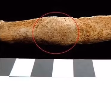 Nhóm nghiên cứu đã tìm thấy một bộ hài cốt bên trong mộ cổ này. Phần hộp sọ đã bị chặt sau khi chủ nhân ngôi mộ chết. Hộp sọ được đặt tách biệt với phần còn lại của thi hài. Ảnh: Nataša Šarkić.