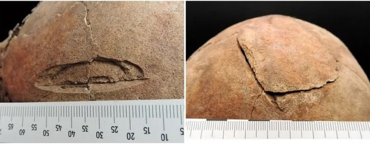 Trong đó, phần thân trên của người đàn ông hướng xuống dưới và các bộ phận cơ thể khác hướng lên trên. Không những vậy, chân của người đàn ông có thể đã bị trật khớp. Ảnh: Nataša Šarkić.