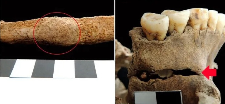 Nataša Šarkić - nhà khảo cổ học độc lập đã nghiên cứu phát hiện này cho hay niềm tin vào ma quỷ, ma cà rồng tồn tại ở nhiều nước Đông Âu thời Trung cổ. Để ngăn người chết "đội mồ sống lại", trở thành ma cà rồng và làm hại người sống, người dân thời xưa đã thực hiện những cách chôn cất "kỳ lạ". Ảnh: Nataša Šarkić.