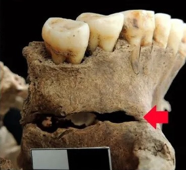 Khi kiểm tra kỹ lưỡng, các chuyên gia xác định thi hài thuộc về một người đàn ông. Sau khi qua đời, thi thể được chôn cất trong tư thế vặn vẹo một cách có chủ ý. Ảnh: Nataša Šarkić.