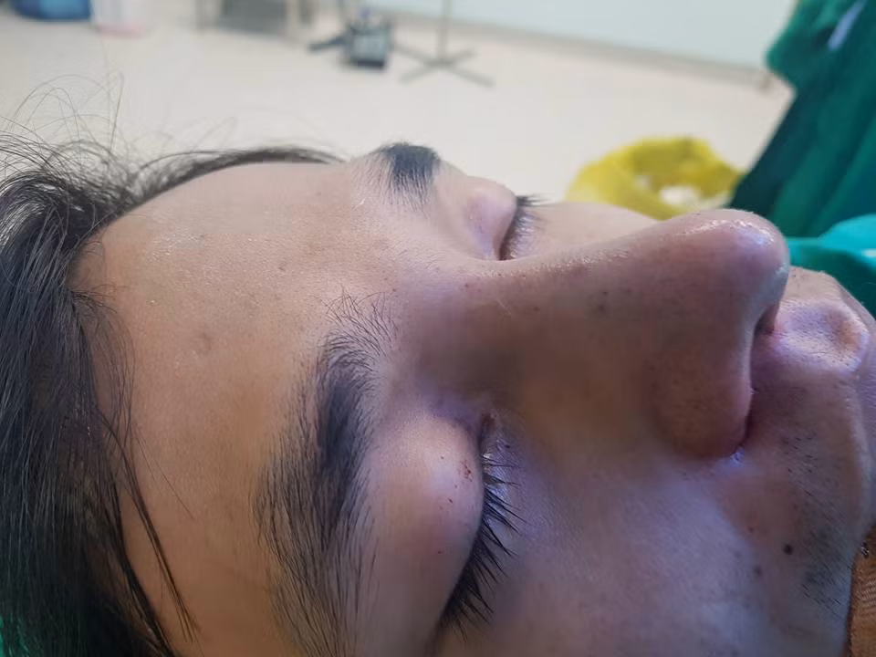 Từ lâu Lệ Rơi - Nguyễn Đức Hậu đã không được đánh giá cao về mặt ngoại hình. Chàng trai trẻ vốn trung thành với cách ăn mặc đơn giản và những hình ảnh của Lệ Rơi đôi khi còn tạo một chút cảm giác về sự "chân chất", "chân quê"... Sự xuất hiện của Lệ Rơi bên cạnh khá nhiều nhân vật nổi tiếng trên mạng như Bella hay Tùng Sơn cùng quyết định làm phẫu thuật thẩm mỹ trong thời gian gần đây khiến dân mạng không thể không nghi ngờ về một kế hoạch nào đó mà nhóm các nhân vật "thảm họa mạng" này đang dự tính cho tương lai.