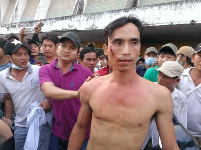 Ban tỏ chúc san Long An bị CDV tó lua dao-Hinh-3