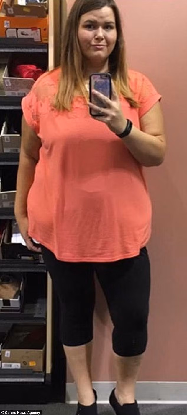 Được biết, Jessica đã tiến hành phẫu thuật thu hẹp dạ dày. Cuộc phẫu thuật này giúp cô giảm các triệu chứng của nhiều bệnh liên quan đến béo phì. 