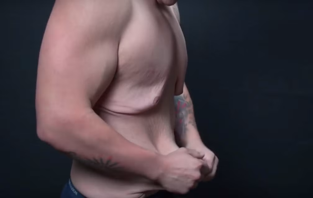 Làn da của anh có thể kéo dài ra như kẹo cao su vậy.