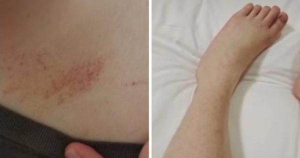 Chan dot nhien noi not, nu sinh khong ngo can ke cua tu