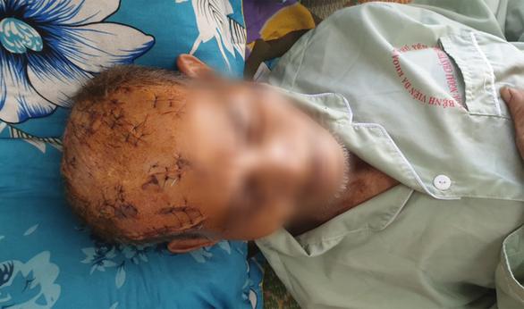 Khoảng 15h ngày 20/4, cụ Tám sang nhà ông T. (ở cùng khu đất) để "hỏi chuyện" thì xảy ra ẩu đả. Theo lời cụ Tám, ông T. và ông M. đã trói cụ lại, đánh, dùng dao chém nhiều cái vào vùng đầu, mặt khiến cụ bất tỉnh. Theo hồ sơ bệnh án ở Bệnh viện Đa khoa tỉnh Phú Yên, cụ Tám có 17 vết thương ở vùng đầu, mặt, vết dài nhất đến 8cm, phải khâu hàng chục mũi.