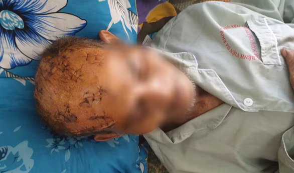 Khoảng 15h ngày 20/4, cụ Tám sang nhà ông T. (ở cùng khu đất) để "hỏi chuyện" thì xảy ra ẩu đả. Theo lời cụ Tám, ông T. và ông M. đã trói cụ lại, đánh, dùng dao chém nhiều cái vào vùng đầu, mặt khiến cụ bất tỉnh. Theo hồ sơ bệnh án ở Bệnh viện Đa khoa tỉnh Phú Yên, cụ Tám có 17 vết thương ở vùng đầu, mặt, vết dài nhất đến 8cm, phải khâu hàng chục mũi.