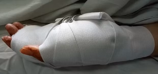  Đắk Nông: Tranh chấp đất rẫy, cô giáo bị chồng cũ chém gần đứt lìa 2 bàn tay: Ngày 20/12/2019, sau khi ly hôn, Đương và vợ cũ xảy ra mâu thuẫn, tranh chấp đất rẫy. Cuối cùng, Đương đã dùng dao chém vợ cũ gần đứt lìa hai bàn tay với tỷ lệ thương tích 74%. 