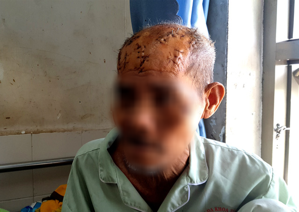  Cụ ông bị con và cháu chém nhiều nhát vì bán đất đi chữa bệnh ung thư: Chỉ vì bán một phần đất để chữa bệnh, cụ Đoàn Tám (74 tuổi) bị con trai cả là Đ.C.T. và cháu ruột Đ.C.M. (con trai ông T.) dùng hung khí chém nhiều nhát vào vùng đầu, mặt, gây thương tích nặng, hiện cấp cứu và điều trị tại Bệnh viện Đa khoa tỉnh Phú Yên.