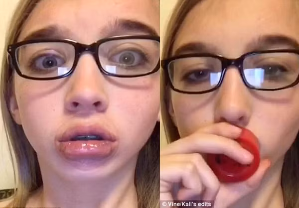 Những người tham gia vào trào lưu kì quái này phải đặt miệng vào một chiếc chén, một cái lọ hoặc một đồ dùng có miệng tròn, đáy kín và dùng hơi sức hút thật mạnh, giữ chặt cho đến khi môi sưng lên.