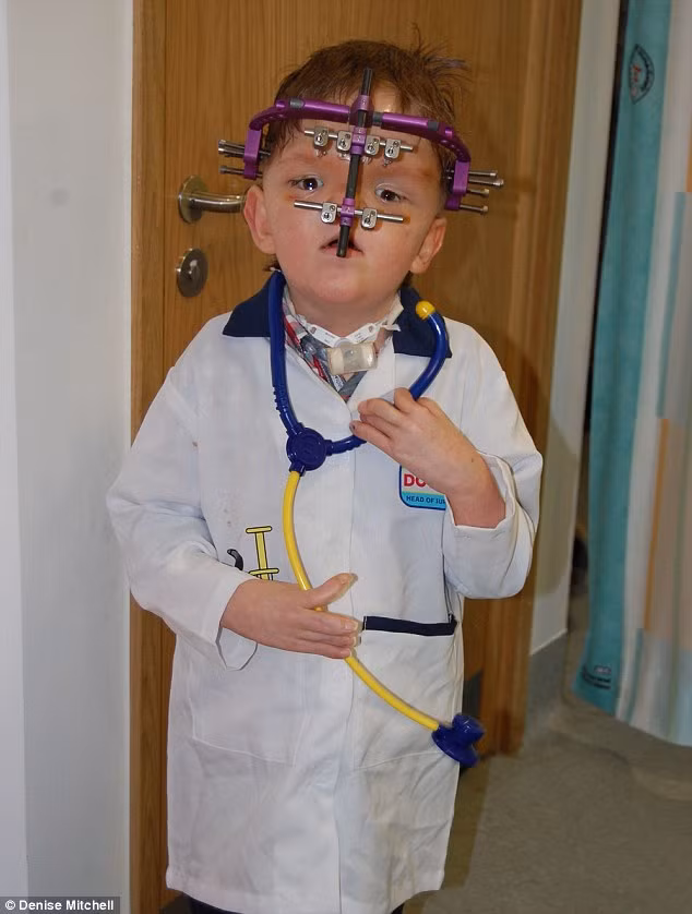 Be 7 tuoi can dam chịu 50 lan phau thuat nao-Hinh-2