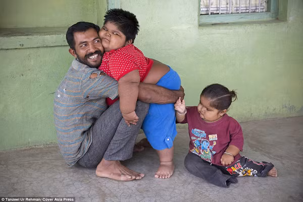 Cha cậu bé, anh Rameshbhai Nandwada phải làm việc cật lực để kiếm tiền mua thức ăn. Anh nói sẽ làm bất cứ công việc nào miễn là có tiền, bởi trung bình mỗi tháng anh phải chi gần 50,000 Rs (hơn 3 triệu đồng) tiền thức ăn cho các con. Riêng chế độ ăn uống "khủng" này đã là một gánh nặng với người cha quanh năm làm thuê với thu nhập vỏn vẹn 10.000 Rs (trên 1,1 triệu đồng)/tháng.