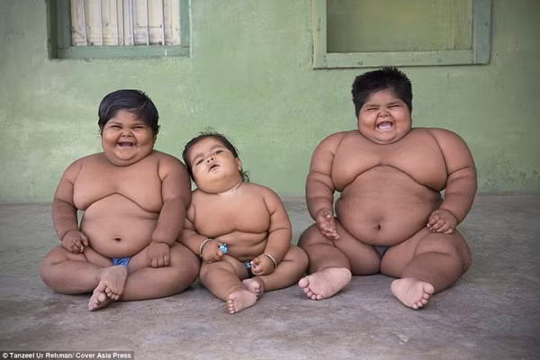 Bi dat cha phai ban than dieu tri beo phi cho con