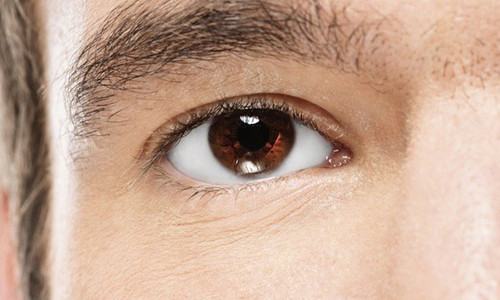 Dấu hiệu 5: Mắt đỏ ngầu. Điều này có nghĩa là bạn có thể bị cao huyết áp. Các mạch máu trong mắt bị hỏng chỉ ra rằng tình trạng cao huyết áp đã gây ra các mạch máu ở võng mạc xoắn lại, khiến chúng vỡ ra. Điều này có thể dẫn đến đột quỵ hoặc trụy tim.