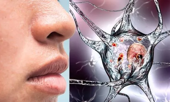 Chu y dau hieu don gian nay canh bao benh Parkinson cuc ky nguy hiem