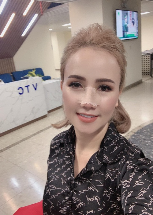 Trước khi bị chồng cũ hành hung, bà mẹ 3 con từng phẫu thuật thẩm mỹ mũi.