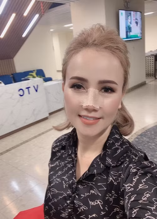 Trước khi bị chồng cũ hành hung, bà mẹ 3 con từng phẫu thuật thẩm mỹ mũi.