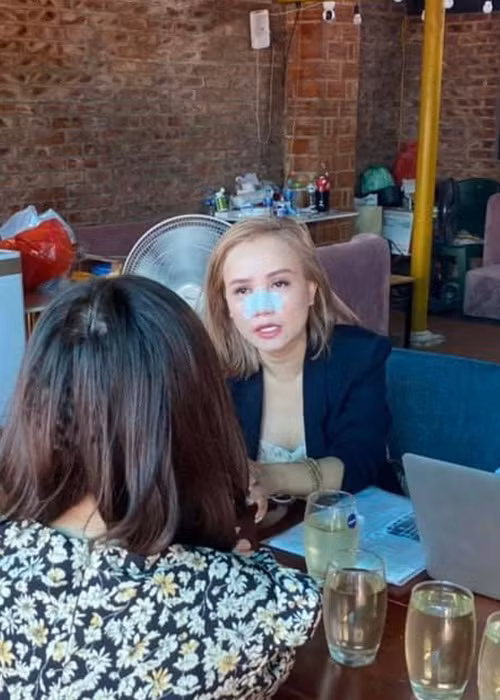 "Cô Xuyến" của "Về nhà đi con" băng bó kín mũi trong thời gian chờ phục hồi.