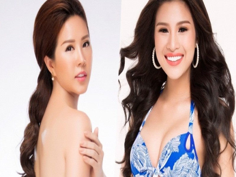 Năm 2016, Thu Hoài bị nghi đứng sau Nguyễn Thị Thành ngụy tạo hồ sơ làm răng sứ vì bị ngã. Nghi vấn rộ lên khi ban tổ chức Hoa hậu Việt Nam đưa ra bằng chứng khẳng định những người đứng đằng sau gồm Hoa hậu H., bầu sô K. Ảnh: Lao động