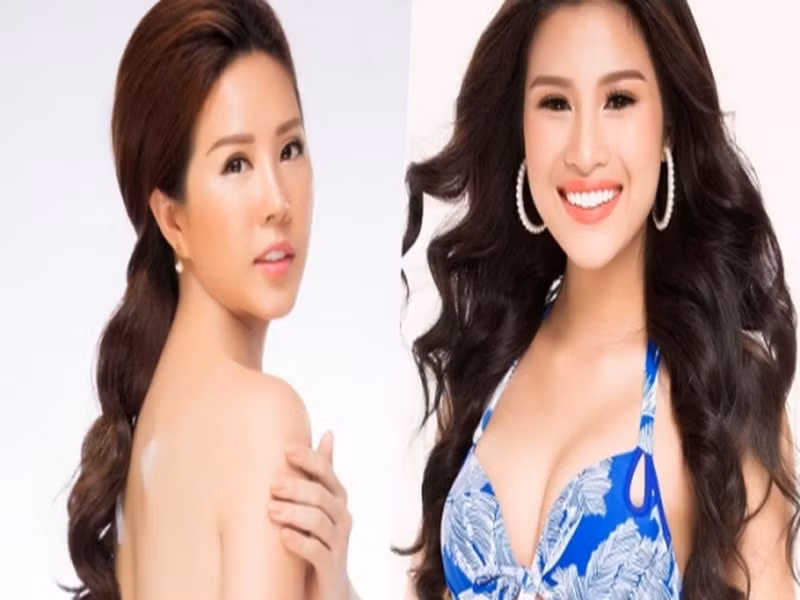 Năm 2016, Thu Hoài bị nghi đứng sau Nguyễn Thị Thành ngụy tạo hồ sơ làm răng sứ vì bị ngã. Nghi vấn rộ lên khi ban tổ chức Hoa hậu Việt Nam đưa ra bằng chứng khẳng định những người đứng đằng sau gồm Hoa hậu H., bầu sô K. Ảnh: Lao động