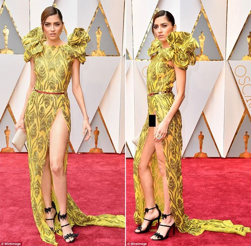 Tại Oscar 2017, cô bị chê vì lộ hàng do chiếc váy xẻ quá cao. Ảnh: WireImage