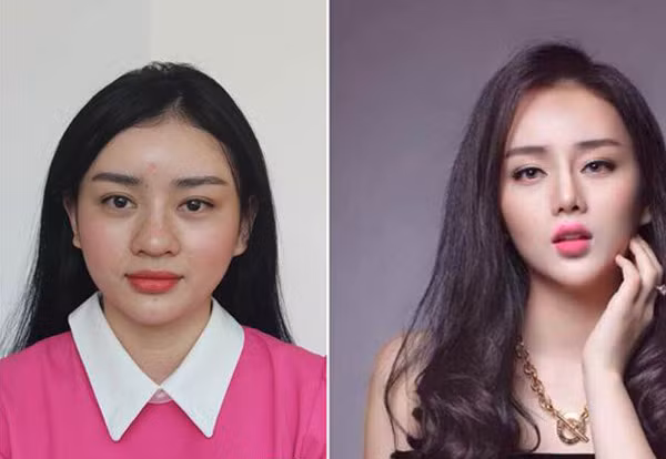 Trước đây, cô gái có khuôn mặt tròn, chiếc mũi to, thô. Nhưng sau khi phẫu thuật thẩm mỹ, Anglela Minh Châu đã có khuôn mặt Vline, sống mũi cao thanh thoát giống hệt Phạm Băng Băng.