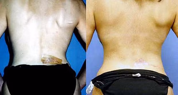 Ngoài ra, có nhiều cách làm đẹp kinh khủng khác của phụ nữ hiện đại tuy chưa có trường hợp nguy hiểm tính mạng nhưng cũng ảnh hưởng nghiêm trọng đến sức khỏe, như cắt xương sườn để eo thon, gọt chân cho vừa giày... Tất cả cho thấy sắc đẹp có thể khiến phụ nữ điên rồ như thế nào.