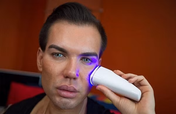 Theo Daily mail, Rodrigo Alves (đến từ Brazil) là một trong những người đàn ông có niềm đam mê với việc làm đẹp. Để trở thành "búp bê sống" phiên bản nam, Rodrigo đã không ngừng dao kéo và nhiều lần suýt chết bởi biến chứng sau khi phẫu thuật. Ảnh: Daily Mail.