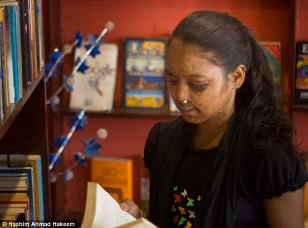 Năm 12 tuổi, Dolly Kumari bị một gã đàn ông 25 tuổi tạt axit vì từ chối quan hệ tình dục với hắn. Axit thấm vào mũi khiến Kumari không thể thở. Dù không ảnh hưởng tới tính mạng, Kumari không dám kết hôn vì những vết sẹo trên mặt. “Cháu muốn là một đứa trẻ mãi mãi vì sẽ không có ai cưới cháu”, cô bé 14 tuổi tâm sự. Kumarri, Geeta hay Neetu chỉ là 3 trong hàng trăm phụ nữ bị tạt axit mỗi năm ở Ấn Độ. Nước này ghi nhận 349 vụ tấn công bằng axit trong năm 2014. Trên thực tế, con số có thể lên tới 1.000 vụ mỗi năm.