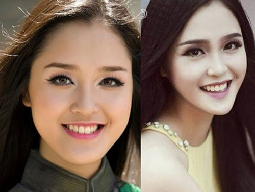 Nhưng dù sao, chiếc cằm nhọn có vẻ hợp với người đẹp.