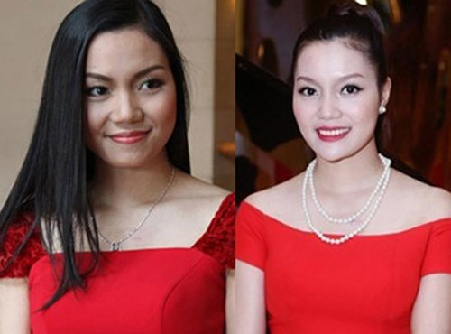 Chiếc cằm gồ ghề nhọn không đúng kiểu của ca sĩ Ngọc Anh khiến cho mọi người thắc mắc. Cô từng thừa nhận tiêm chất làm đầy vào cằm. Cằm Vline đang là mốt bởi nó khiến khuôn mặt vốn tròn trịa và hơi nặng của đa phần phụ nữ Á trở nên thanh thoát hơn. Tuy nhiên, khuôn cằm nhọn hay tròn sẽ chỉ đẹp khi hài hòa với gương mặt. 