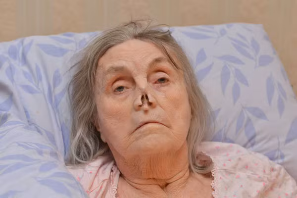 Để hạn chế nguy cơ ung thư mặt, cần tránh thuốc lá, bia rượu, vệ sinh răng miệng và mũi họng thật tốt. Khám và điều trị kịp thời các bệnh vùng đầu, mặt, cổ, định kỳ kiểm tra sức khỏe để tầm soát ung thư.