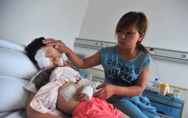 Tiếp đến là vụ một bé gái 5 tuổi tại Hồ Châu, Bắc Kinh bị chó ngao Tây Tạng tấn công khiến khuôn mặt bé bị thương nghiêm trọng và phải khâu 60 mũi.