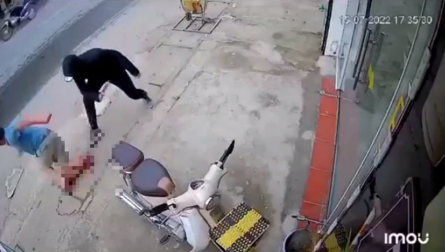 Ha Noi: Dang di tren duong, nguoi dan ong bi chem dut lia chan